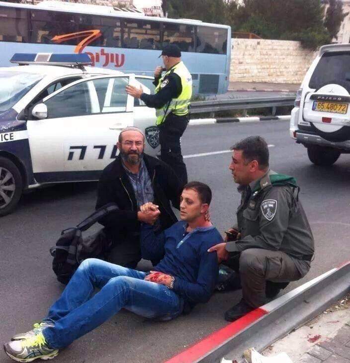 القدس : عملية دهس وانباء عن عدد من المصابين ومقتل منفذه ابراهيم العكاري من شعفاط  